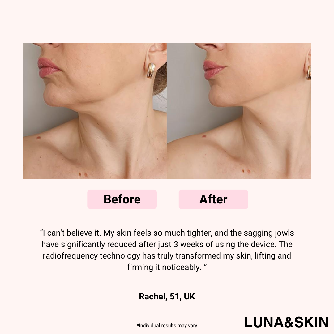 LUNA&SKIN Booster Pro™