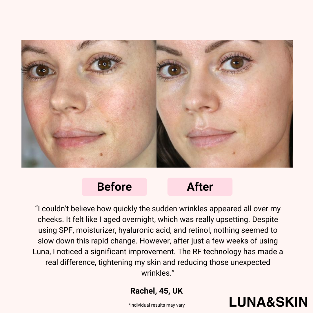 LUNA&SKIN Booster Pro™